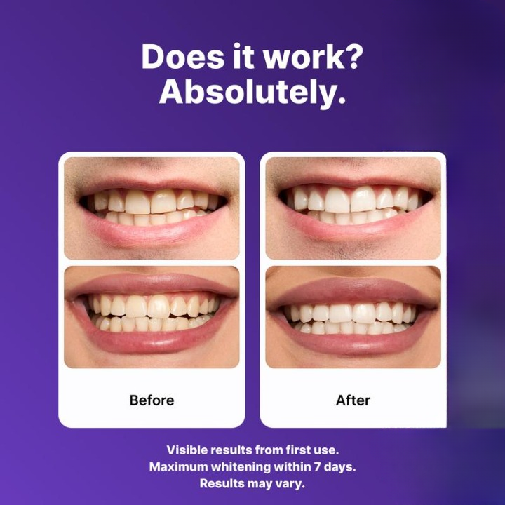 Whitening Tooth Strips